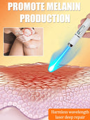 blue light pen solve Vitiligo,2025 NEW hot sale leg care tools