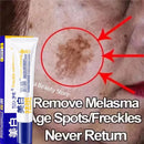 Spot Remover Cream – Fade Melasma & Even Skin Tone Fast
