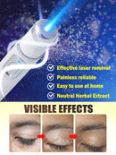 blue light pen solve Vitiligo,2025 NEW hot sale leg care tools