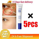 Spot Remover Cream – Fade Melasma & Even Skin Tone Fast