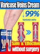 Varicose Vein Cream – Relieves Pain & Reduces Spider Veins ✅