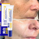 Spot Remover Cream – Fade Melasma & Even Skin Tone Fast