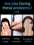 blue light pen solve Vitiligo,2025 NEW hot sale leg care tools