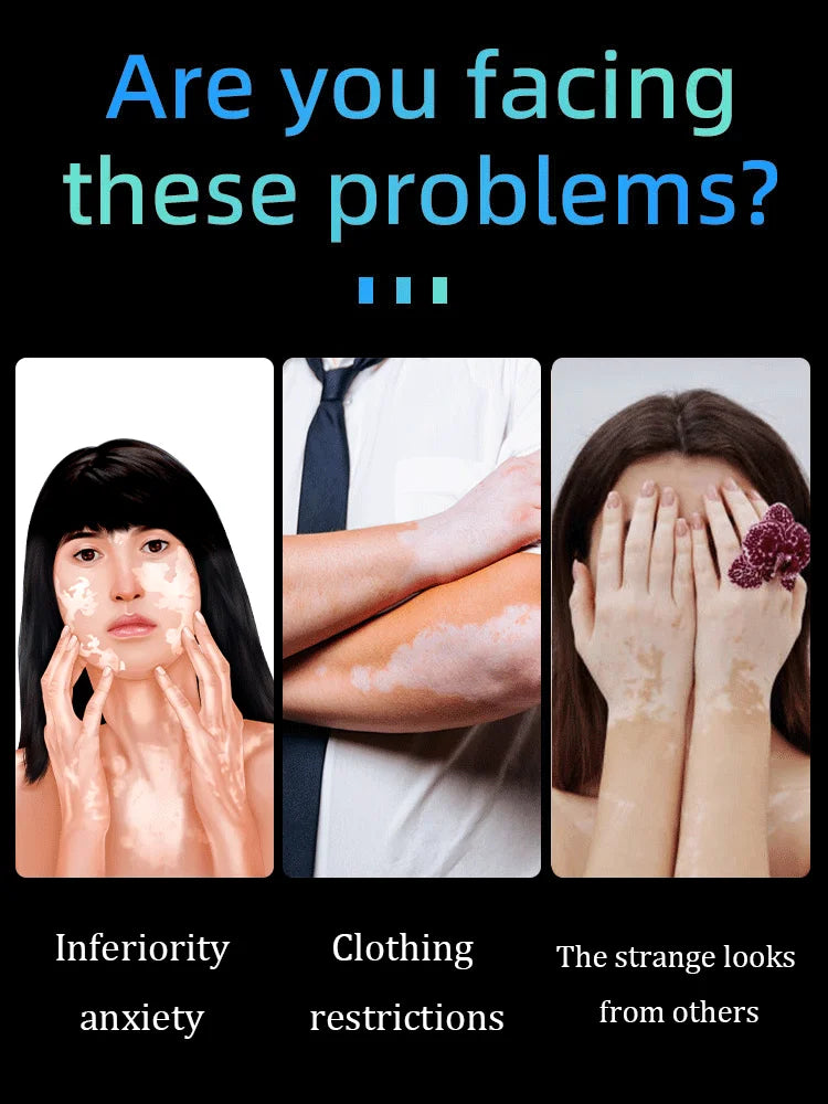 blue light pen solve Vitiligo,2025 NEW hot sale leg care tools