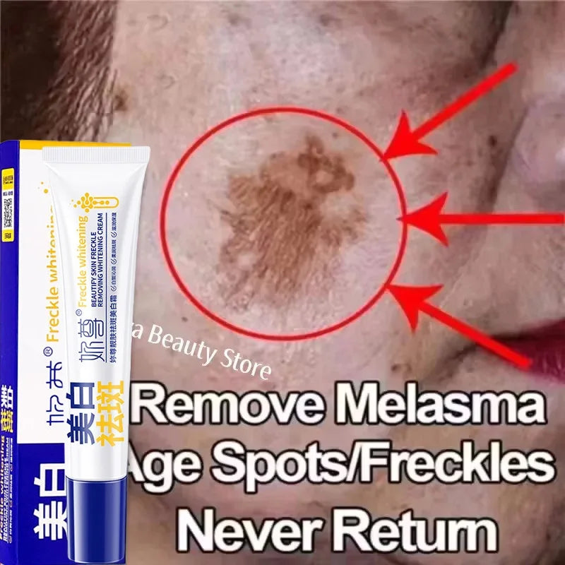 Spot Remover Cream – Fade Melasma & Even Skin Tone Fast