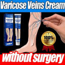 Varicose Vein Cream – Relieves Pain & Reduces Spider Veins ✅