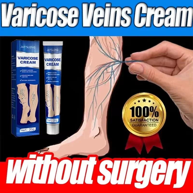 Varicose Vein Cream – Relieves Pain & Reduces Spider Veins ✅