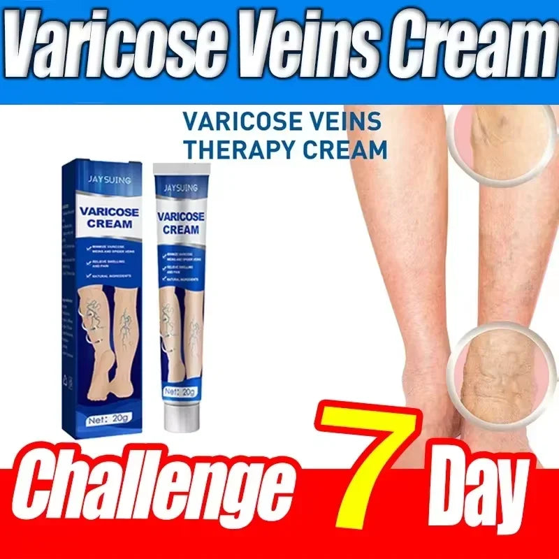 Varicose Vein Cream – Relieves Pain & Reduces Spider Veins ✅