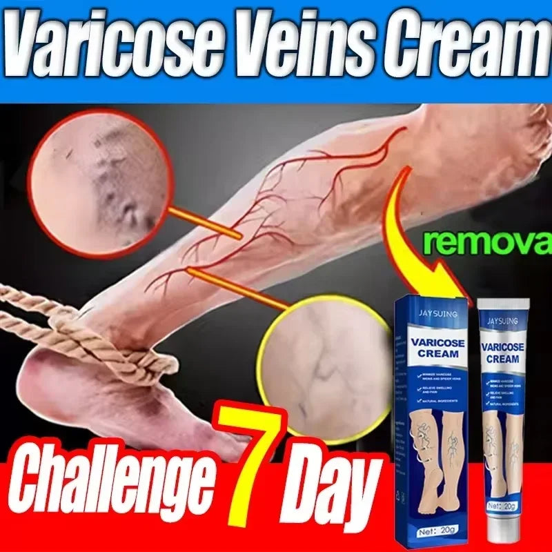 Varicose Vein Cream – Relieves Pain & Reduces Spider Veins ✅