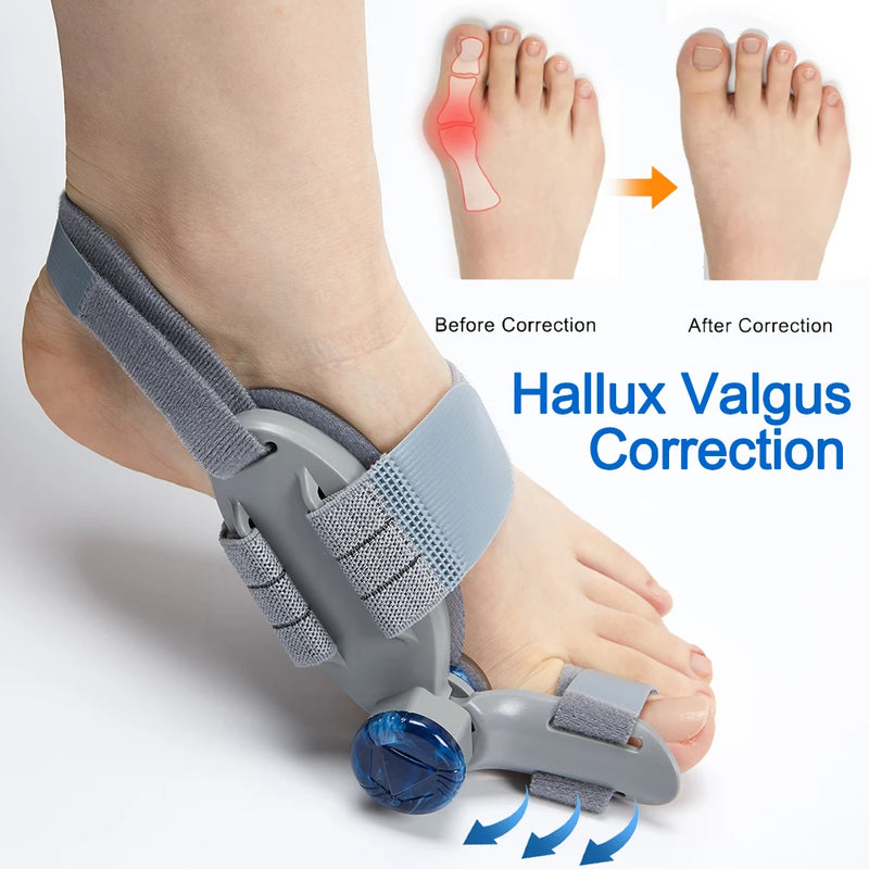 Bunion Corrector – Big Toe Straightener & Pain Relief Splint