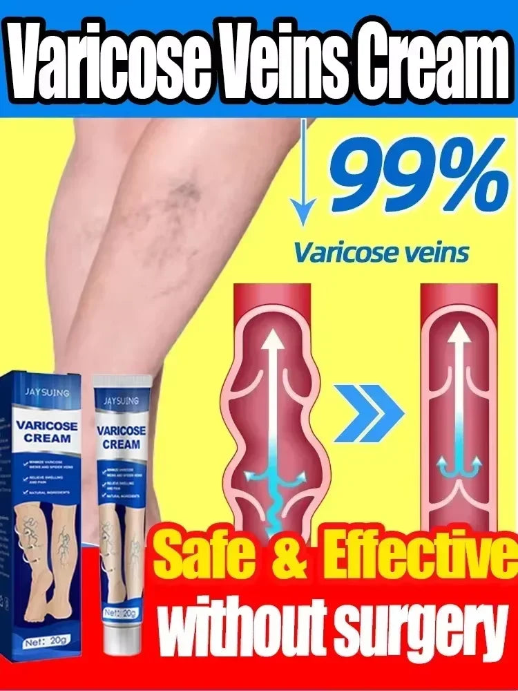 Varicose Vein Cream – Relieves Pain & Reduces Spider Veins ✅